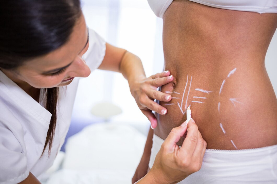 Bodysculpting treatment at HMS Fat Freezing Dubai
