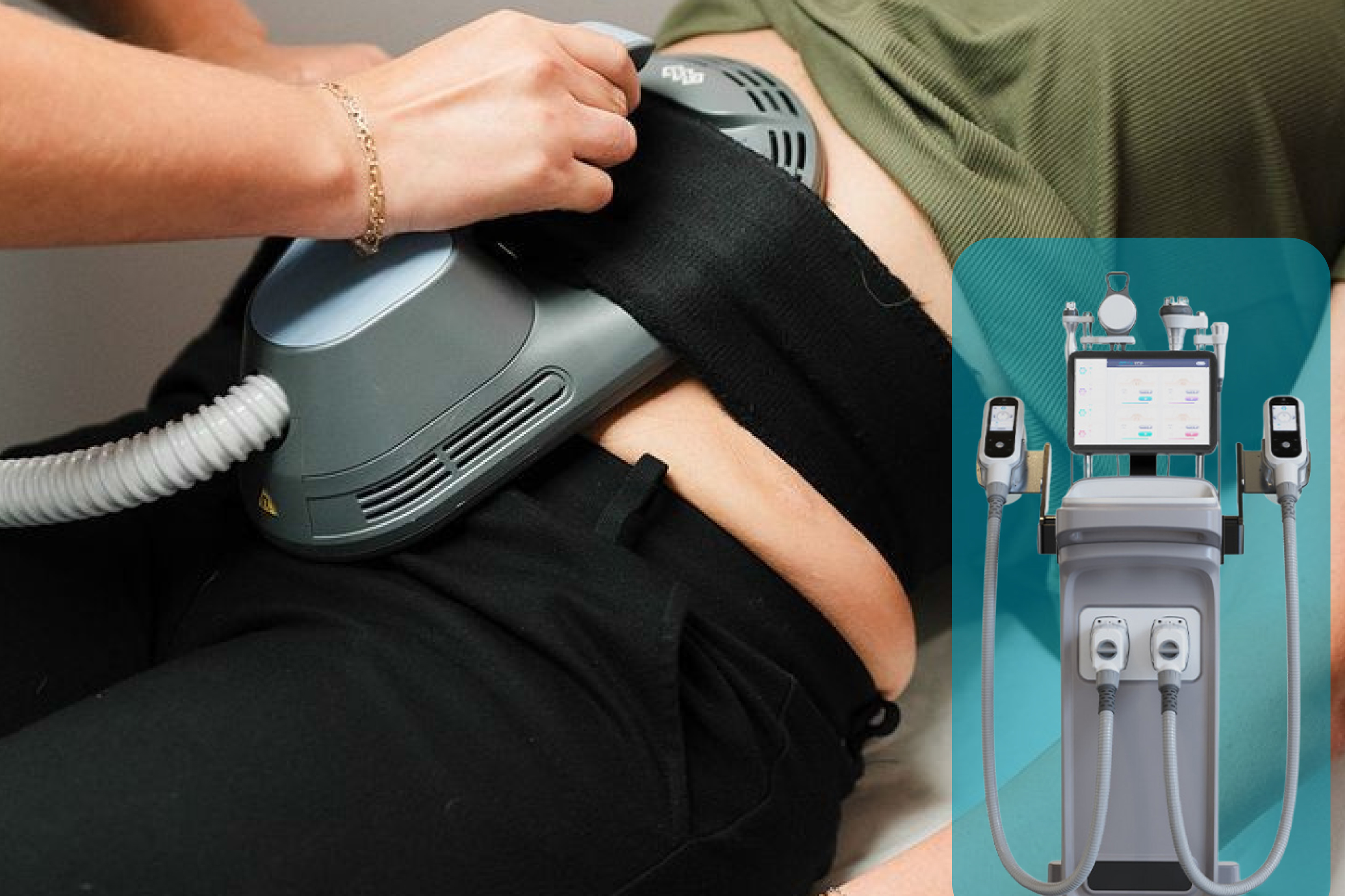 Bodysculpting treatment at HMS Fat Freezing Dubai