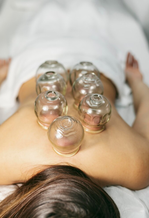 Hijama and Wellness Therapy Dubai