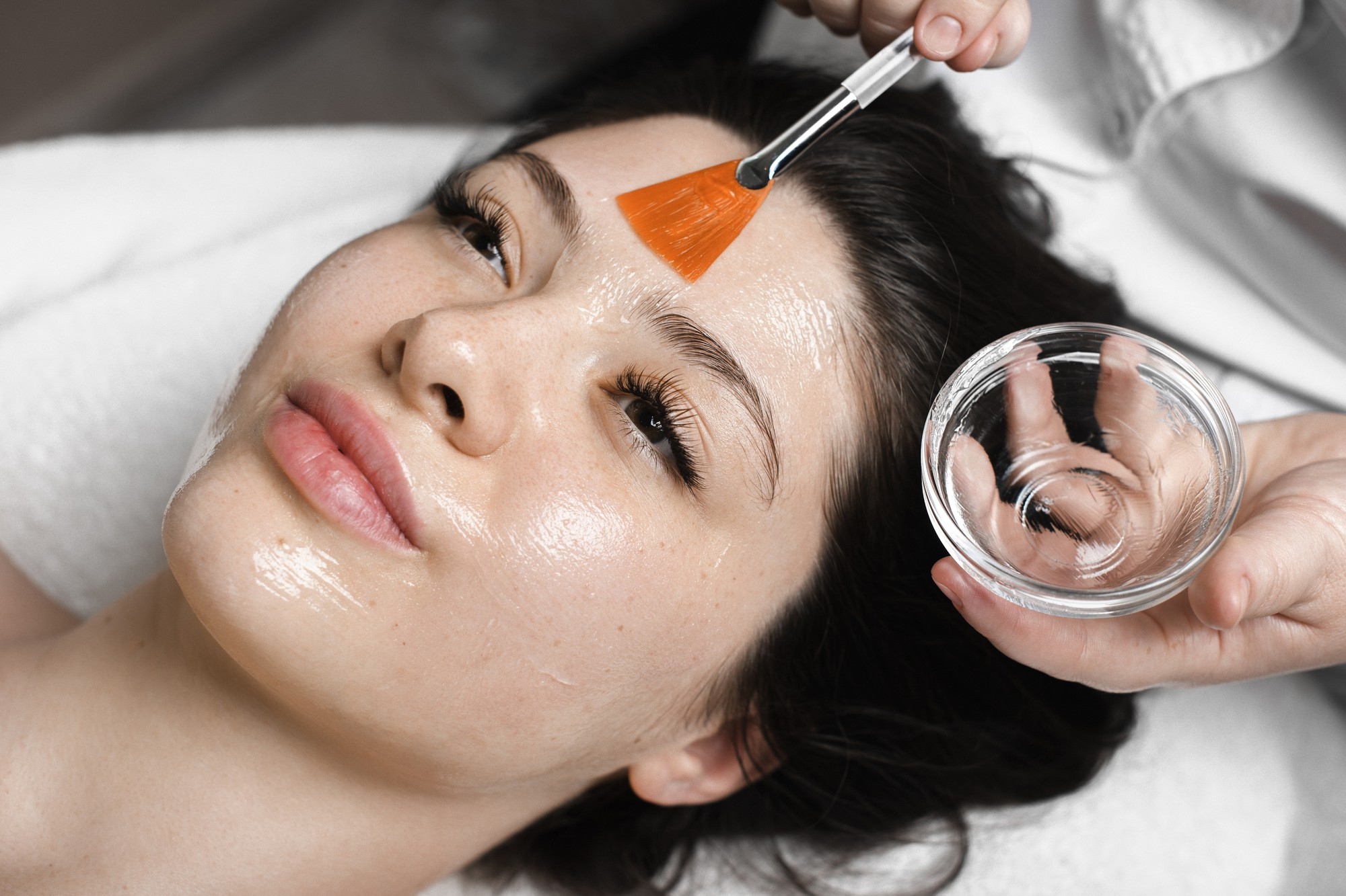 Professional Chemical Peel treatment for glowing skin at HMS Fat Freezing Dubai