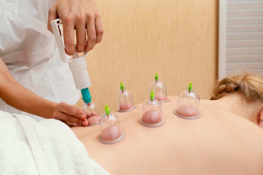 Hijama Therapy for Stress and Muscle Recovery: Complete Wellness Guide | HMS Fat Freezing Dubai