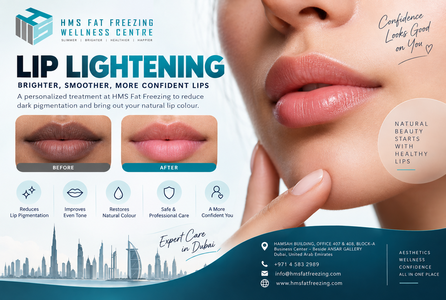 Lip Lightening treatment in Dubai for dark and uneven lip pigmentation at HMS Fat Freezing